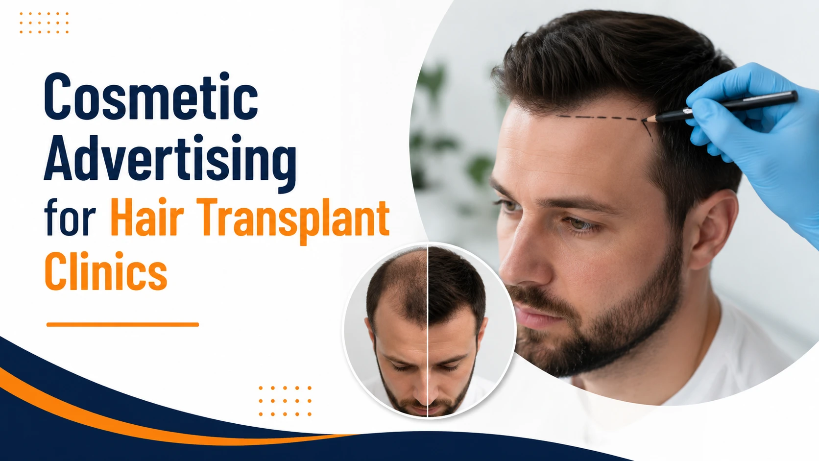Cosmetic Advertising for Hair Transplant Clinics
